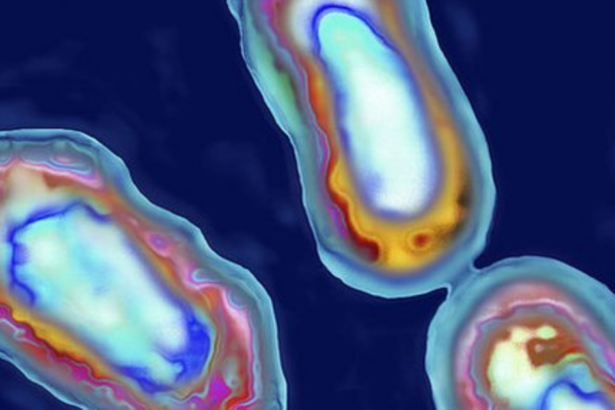 OMS solicita a Rusia informes por muerte en laboratorio de Siberia